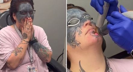Taylor White está removendo a tatuagem após mais de dez anos
