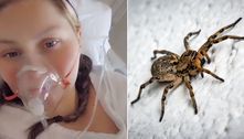 Mulher que teve perna amputada após picada de aranha ainda sente cãibra no membro perdido