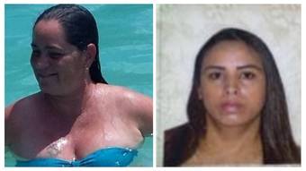 Cirurgião de mulher que morreu após plástica em BH já responde outro processo