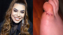 Naiara Azevedo sofre acidente com faca e leva cinco pontos: 'Saiu muito sangue' 