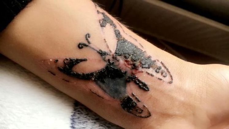 Tatuagem de borboleta feita em mulher dá muito errado e a deixa