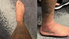 Neymar compartilha foto de tornozelo inchado após lesão