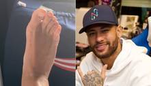 Neymar posta pé recuperado e usa música para dar indireta: 'Pessoas dizem m... sobre o jeito que eu sou'