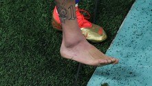 Seleção brasileira tenta manter ânimo elevado mesmo com entorse no tornozelo de Neymar