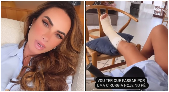 Nicole mostrou o pé engessado e disse que vai passar por cirurgia 