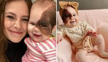 Mãe de menina com marca de nascença rara no rosto mostra à filha que ela é linda 