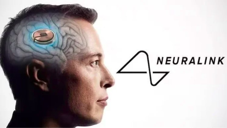 No domingo (28/01), a Neuralink, empresa do bilionário Elon Musk, realizou com sucesso o primeiro implante de um chip cerebral em um ser humano.