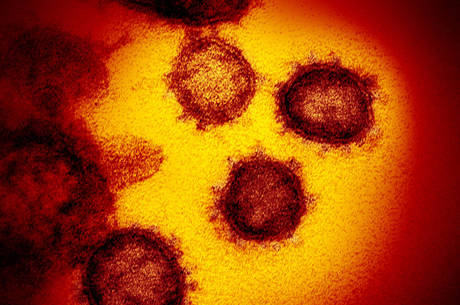 Primeiro caso de coronavírus no Brasil foi confirmado