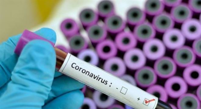 Resultado de imagem para Cuba tem antiviral para tratar coronavírus e pode exportá-lo