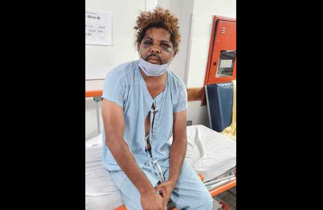 O morador de rua se chama Givaldo Alves de Souza, tem 48 anos e foi socorrido na emergência, com as lesões causadas pela agressão. 