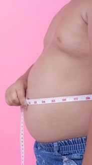 Associação indica bariátrica a crianças com obesidade