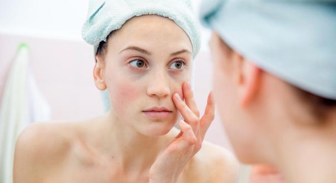 Olheira: O que é, como tratar e evitar