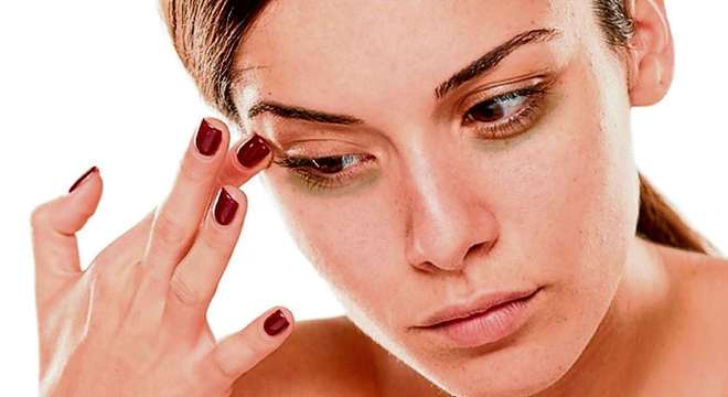 Olheiras: O que é, como tratar e evitar