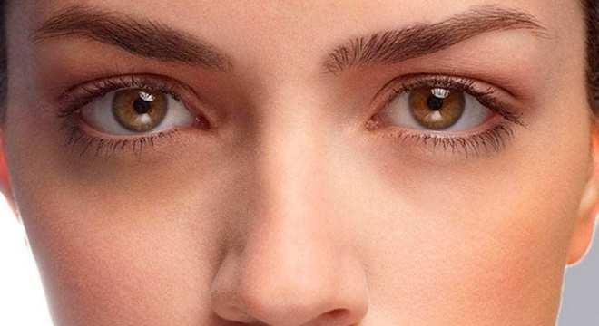 Olheiras: O que é, como tratar e evitar