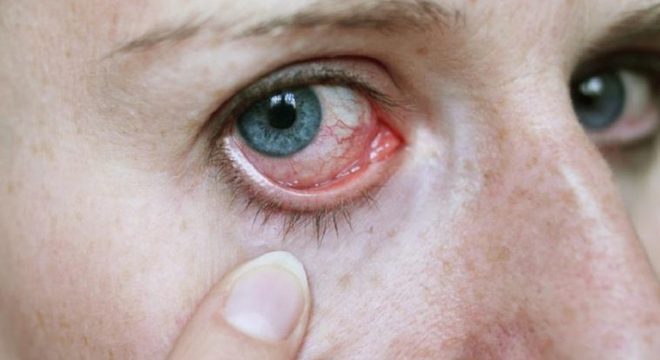 Olho tremendo: entenda as causas e como parar com o espasmo