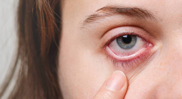 A retina é uma camada fina que recobre todo o interior do globo ocular 