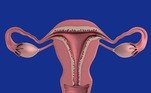 ovário-utero-ovulo