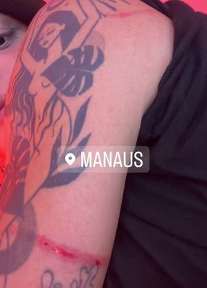 Pabllo ficou com arranhões em um dos braços
