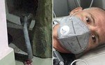 Um paciente britânico que se recuperava da covid-19 acabou cego e paralisado após ter sido picado por uma cobra-real negra, em um vilarejo no noroeste da Índia