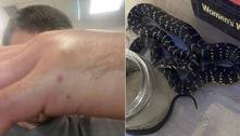 Pai aparece com serpente em casa para mostrar aos filhos e acaba hospitalizado