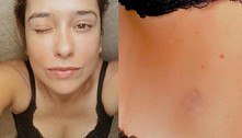 Paloma Duarte exibe o corpo em diferentes ângulos, e falta de umbigo chama a atenção