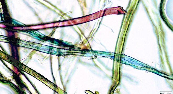 Partículas podem ser microscópicas