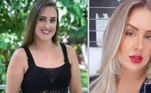 Patrícia LeitteA influenciadora, de 36 anos, também fez procedimentos neste ano e chocou seguidores ao revelar que já havia gastado cerca de R$ 150 mil em procedimentos estéticos. 'Tudo isso não foi agora. Eu venho de um processo de mudança de um tempo para cá', explicou ela. Patrícia contou também que faz aplicação de Botox a cada quatro meses. Na imagem acima, você vê uma imagem mais antiga de Patrícia e outra tirada atualmente