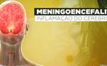 A meningoencefalite é uma inflamação do cérebro e das membranas que o revestem. Devido a isso, houve um agravamento do processo inflamatório generalizado, afetando múltiplos órgãos e piora, principalmente, neurológica, que levou a necessidade de intubar a cantora