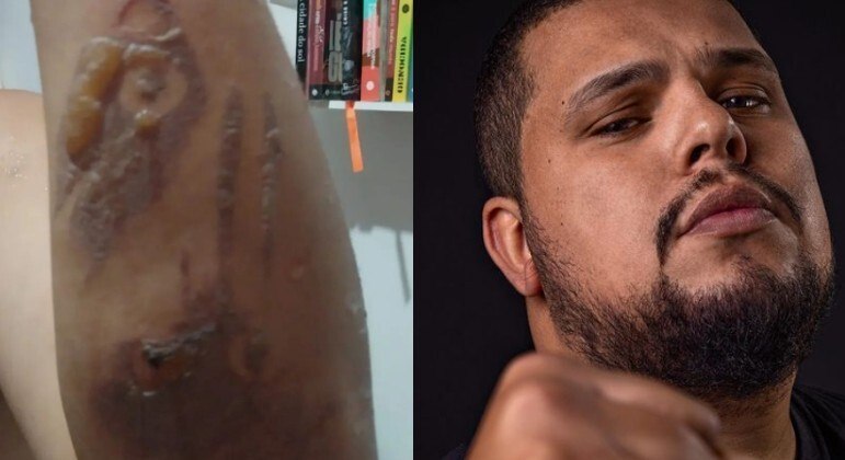 Nas redes sociais, o motoboy Paulo Galo diz ter sofrido violência policial