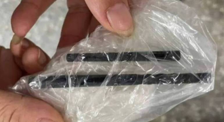 Homem ficou cinco meses com os pauzinhos na cabeça
