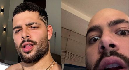 Pedro Sampaio antes e depois de aparecer careca