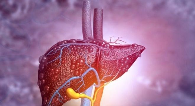 Pele amarelada - principais condições de saúde que provocam a mudança