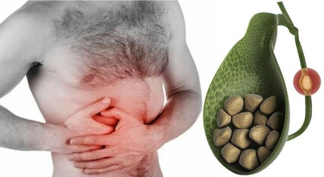 Pele amarelada - principais condições de saúde que provocam a mudança