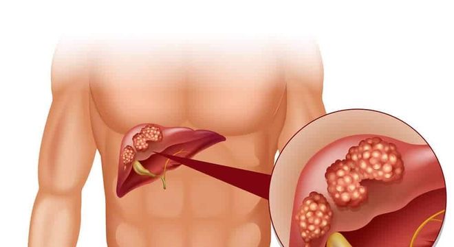 Pele amarelada - principais condições de saúde que provocam a mudança