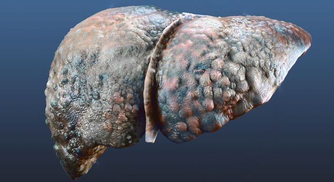 Pele amarelada - principais condições de saúde que provocam a mudança