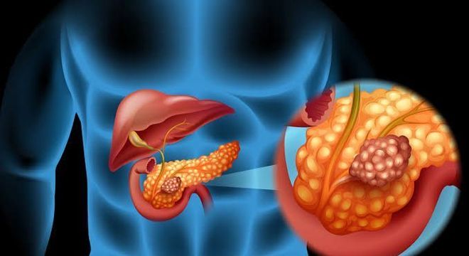 Pele amarelada - principais condições de saúde que provocam a mudança