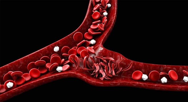 Pele amarelada - principais condições de saúde que provocam a mudança