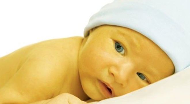 Pele amarelada - principais condições de saúde que provocam a mudança