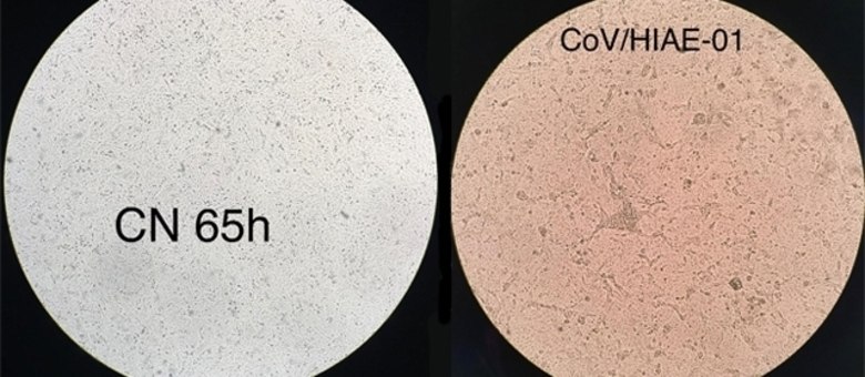 À esquerda uma célula humana não infectada; à direita, o coronavírus multiplicando-se em célula cultivada em laboratório