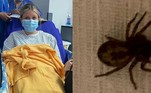 Uma estudante inglesa de 18 anos passou por momentos tenebrosos após ser picada por uma aranha conhecida como falsa-viúva (Steatoda nobilis) durante uma viagem turística, em um parque da região de Gales