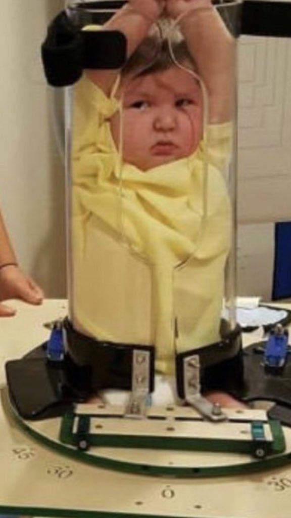 Liquidificador? Fotos de aparelho de raiox para crianças viram memes