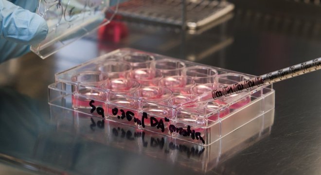  Estudo gerou as chamadas células tronco pluripotente induzidas (iPSCs, na sigla em inglês) 