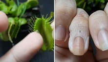 Desafio insano: tiktoker deixa o dedo em uma planta carnívora durante 24h