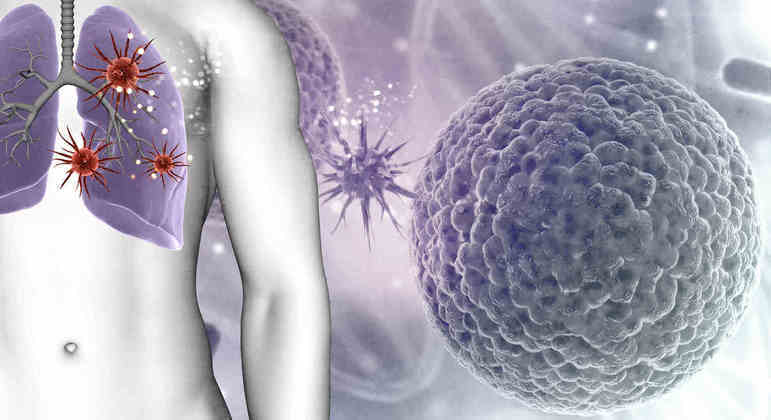 Origem do surto de pneumonia bilateral ainda é desconhecida