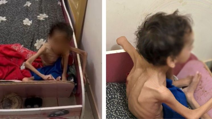A polícia prendeu os pais de uma criança de 7 anos, encontrada abandonada em uma casa, com quadro grave de desnutrição, na cidade de Aparecida de Goiânia, em Goiás, na madrugada do último domingo (12). Ao chegarem ao endereço da ocorrência, os agentes encontraram um menino, de 7 anos, com necessidades especiais, sozinho na casa, em um quarto escuro, 