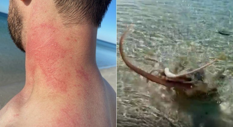 Polvo golpeou o pescoço de banhista com um dos tentáculos, em praia na Austrália