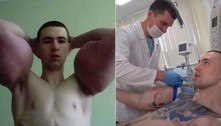 Popeye russo terá 3ª cirurgia para remover vaselina do braço