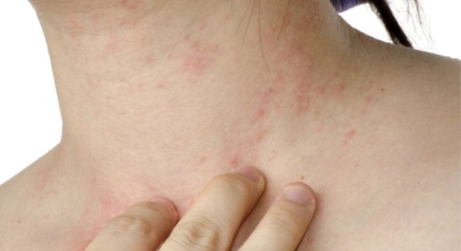 Por que precisamos tomar banho? Com que frequência?