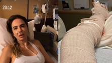 Após aparecer na cama de hospital, Luciana Gimenez mostra perna enfaixada e desabafa: ‘Muita dor’