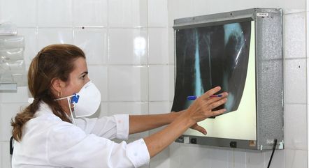 Proposta é reduzir tratamento de tuberculose para seis meses